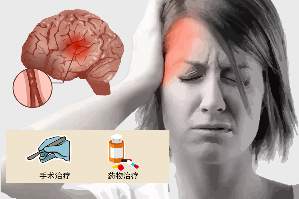 脑供血不足
