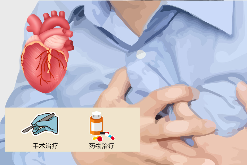 心脏神经官能症
