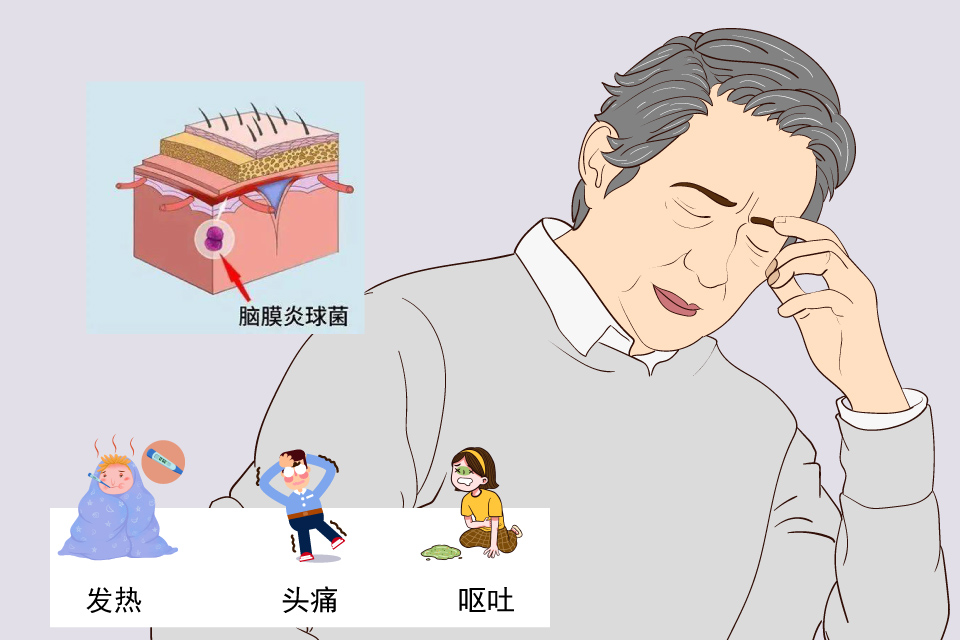 脑膜炎