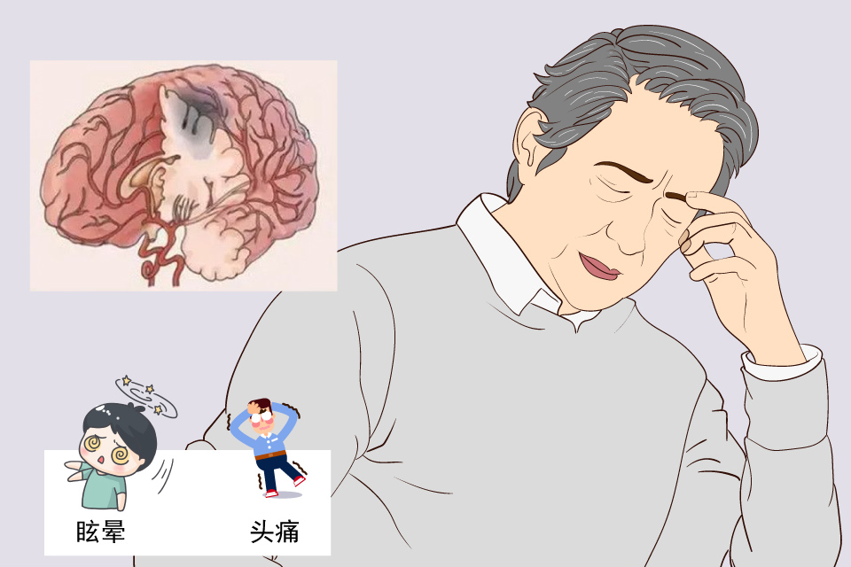 面瘫病