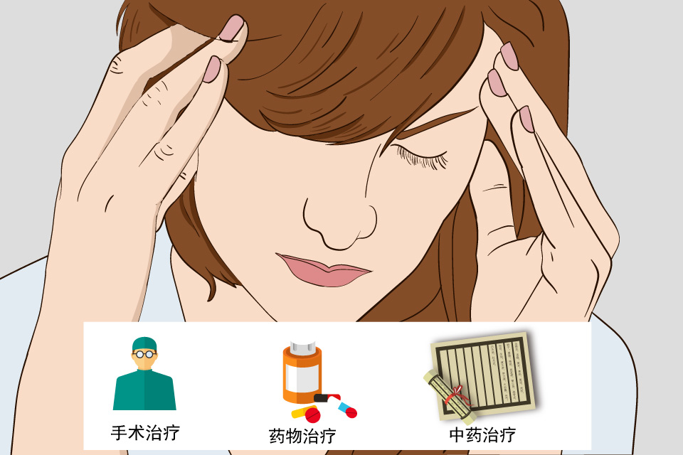 三叉神经痛