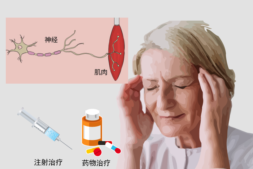 面神经麻痹