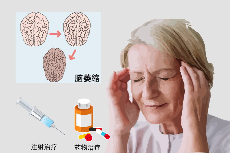小脑萎缩
