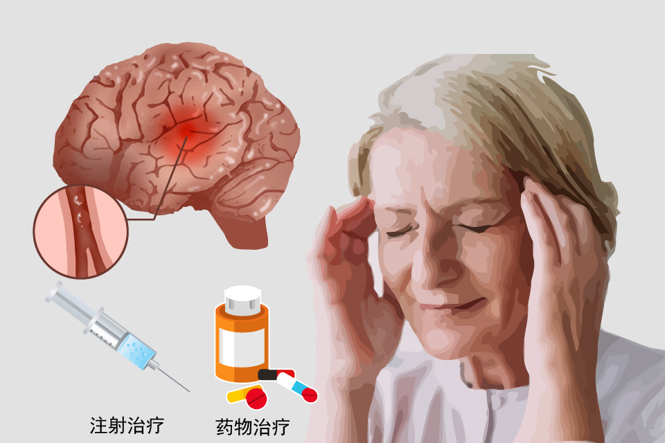 脑缺血