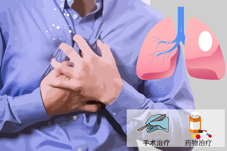 肺大疱