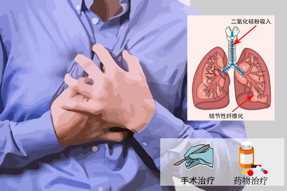 矽肺