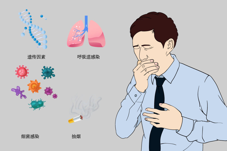 过敏性哮喘