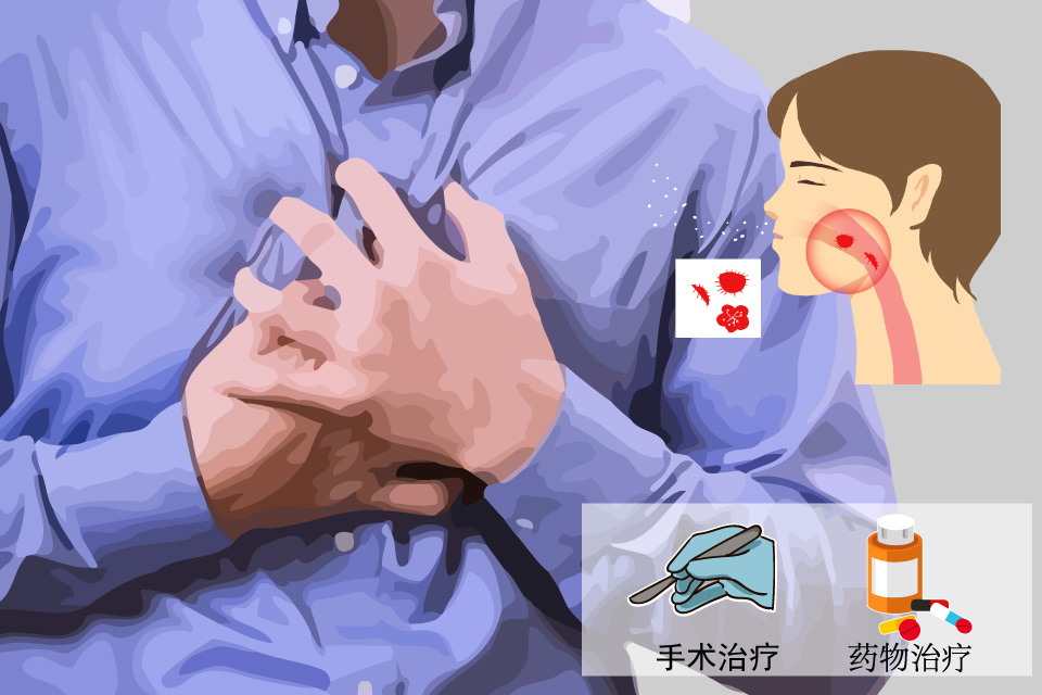 支气管结核
