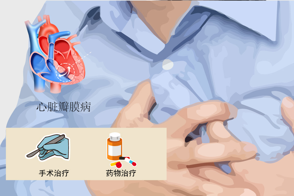 心脏瓣膜病