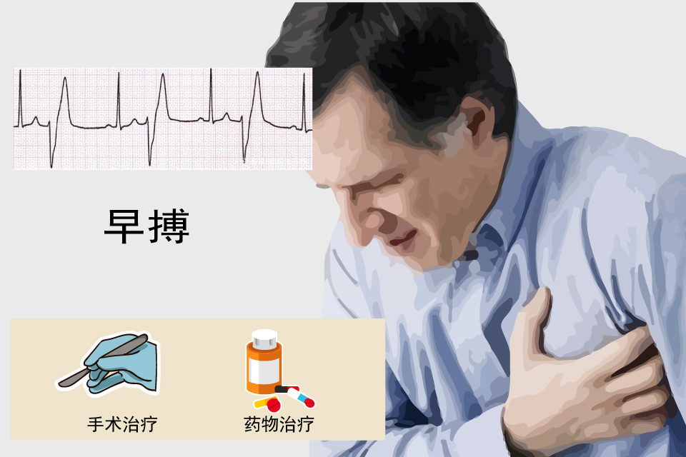 早搏