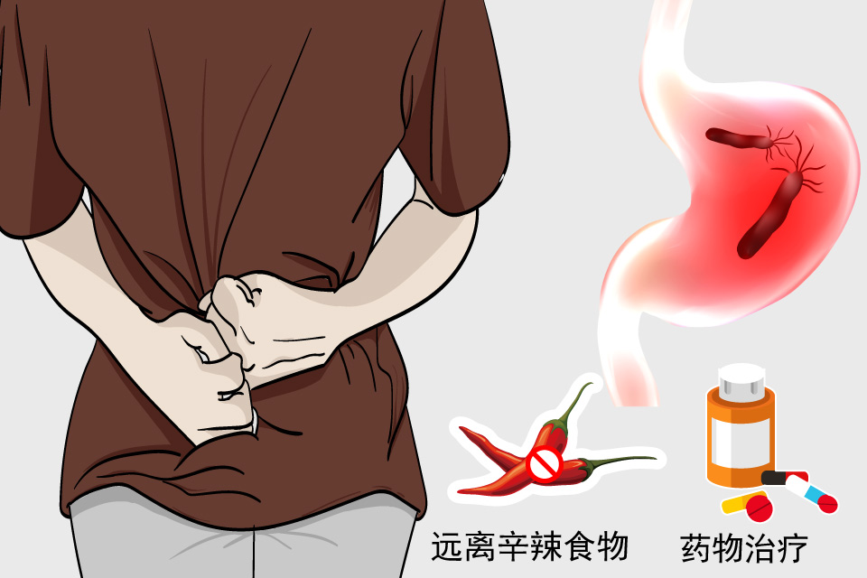 慢性胃炎