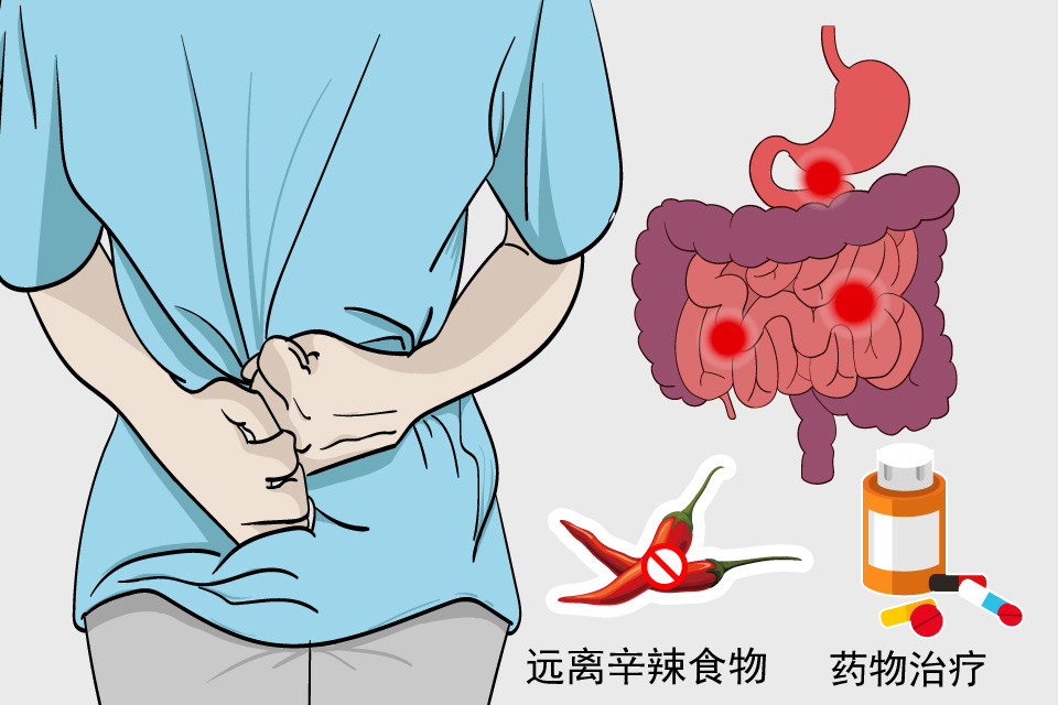 急性胃肠炎