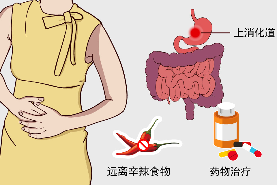 上消化道出血