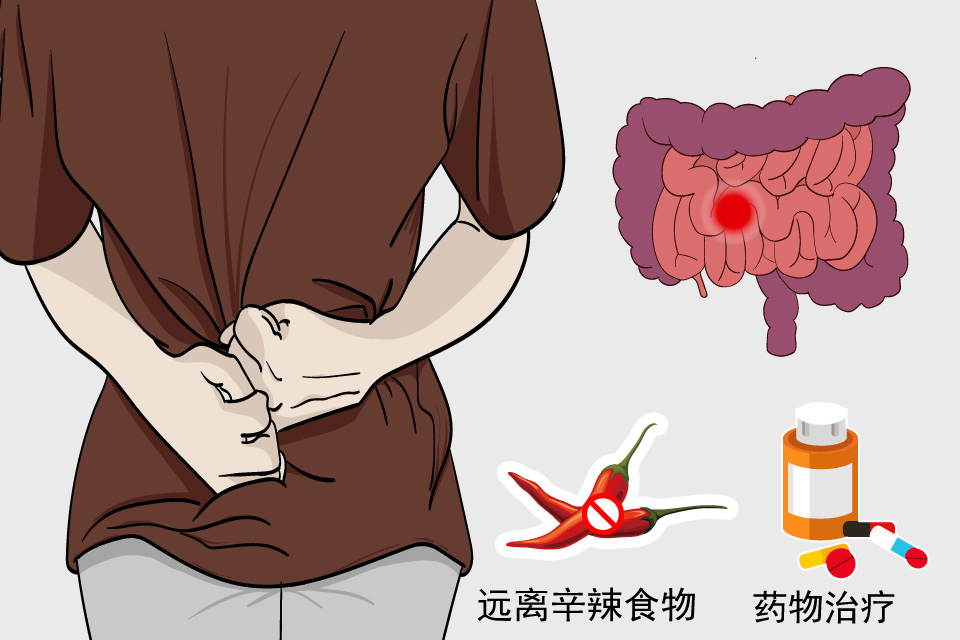 慢性肠炎