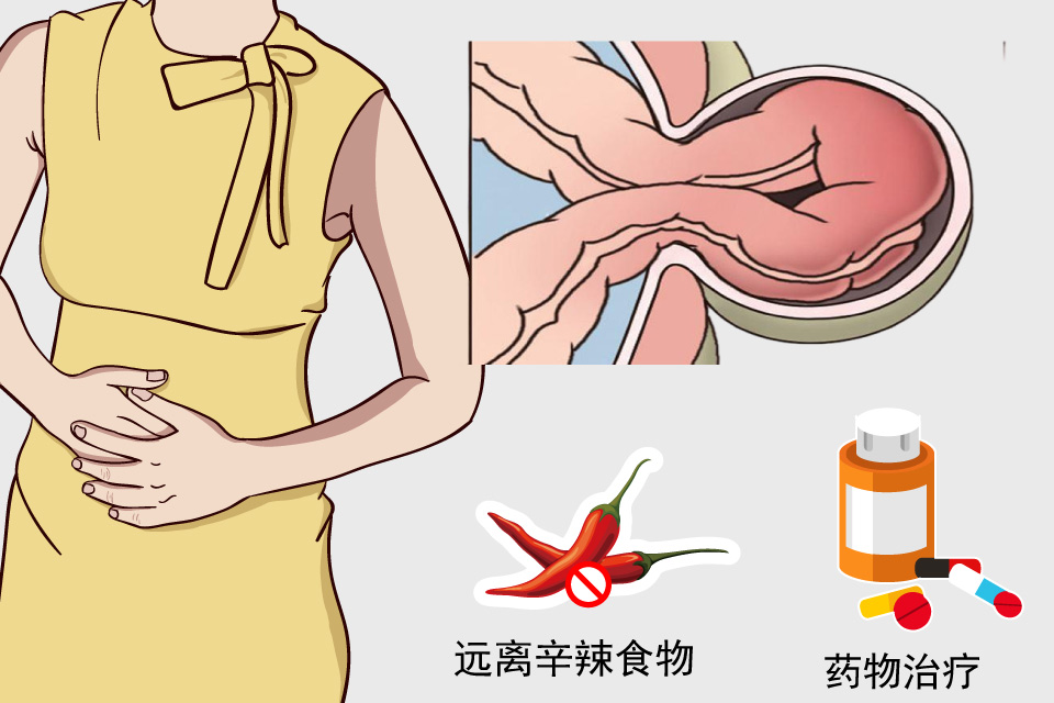 机械性肠梗阻