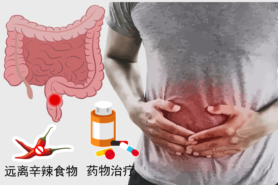 直肠炎
