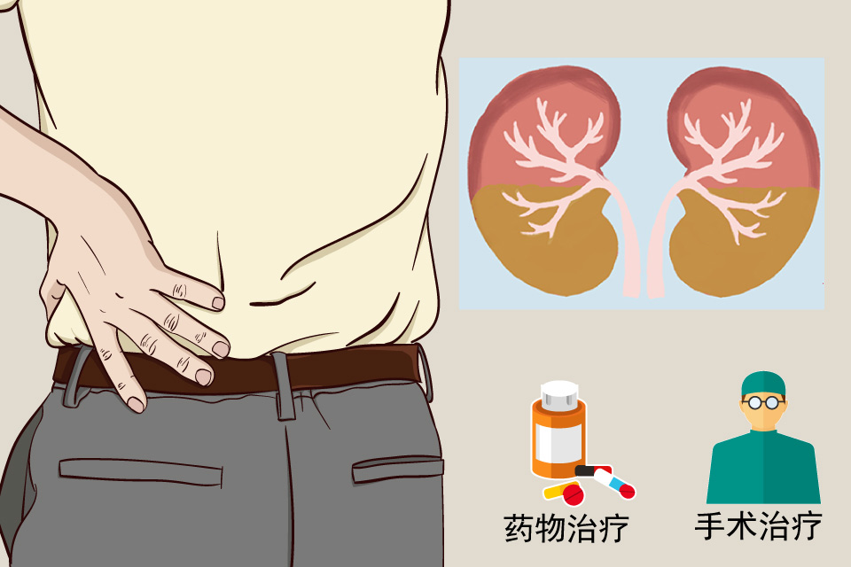高尿酸血症