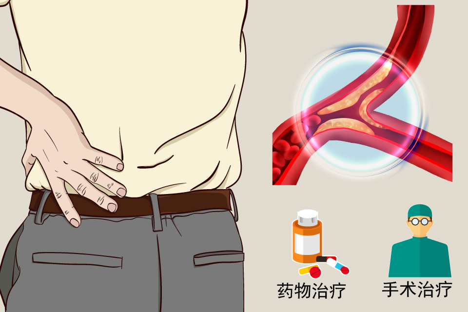 胆固醇升高