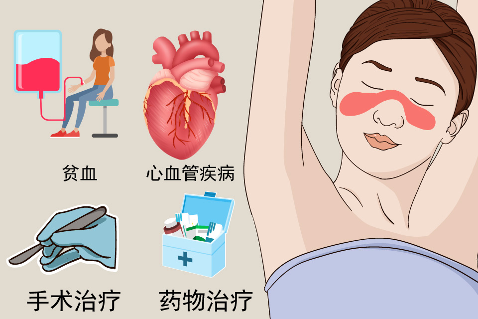 红斑狼疮